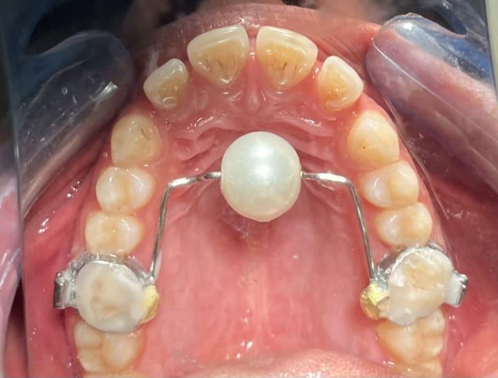 Photo 11 from BR Dental Hospital, New Road, Ghorahi, Dang